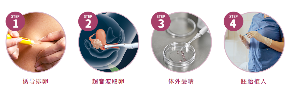香港試管嬰兒過程